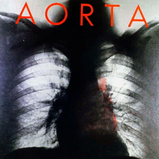 Aorta1